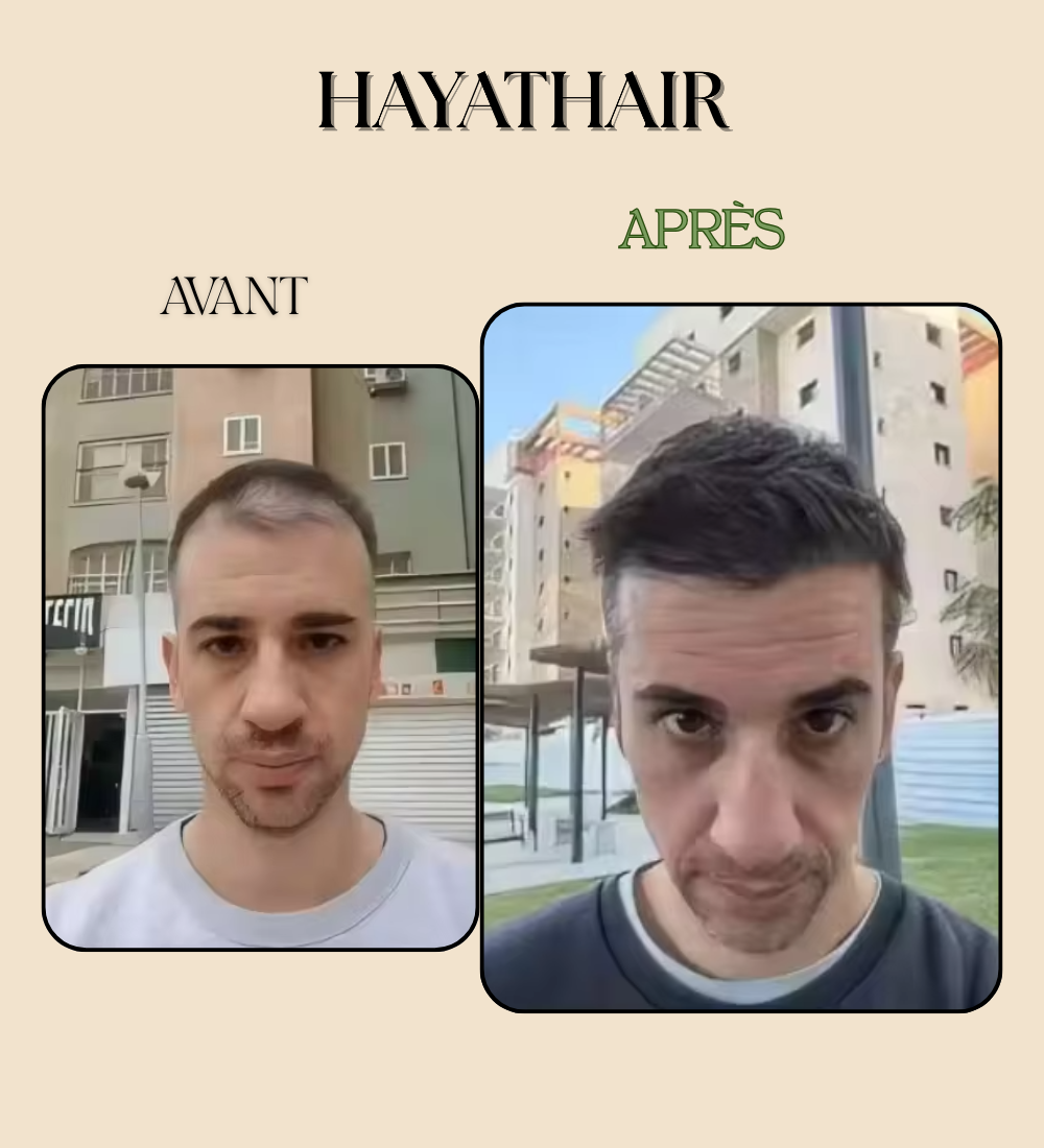 Savon Solide Anti-Chute & Pousse Herbes Naturelles