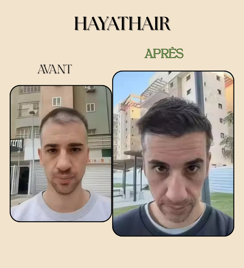 Savon Solide Anti-Chute & Pousse Herbes Naturelles