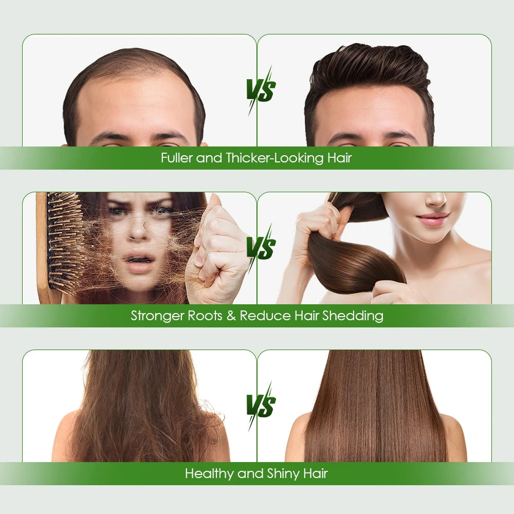 Hair Regrowth System Advanced Hair Growth Treatment with Ginseng Rosemary Oil & Ginger Root Thickening Hair Ampoule Serum